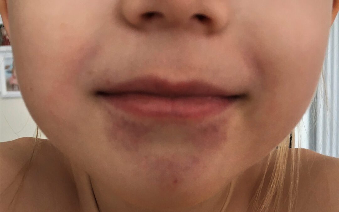 Dr.Ohhira nahalööve